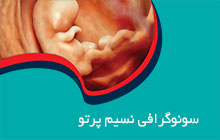 سونوگرافی در منطقه 6